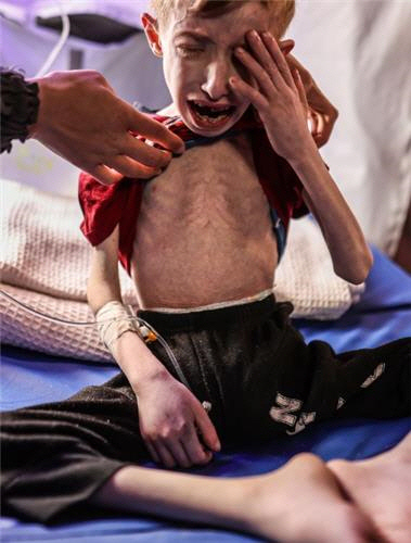 지난 3월 병원에서 치료 받던 파디 알잔트. [엑스 @alijadallah66 캡처]